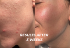Daily Calm + Restore Cream